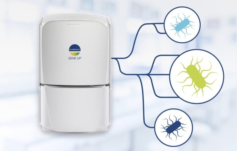 Llega a la industria alimentaria un nuevo sistema detector de Salmonella. Mucho más preciso que los anteriores.